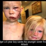 Bridger a 6 year boy saves his younger sister from Dog Attack