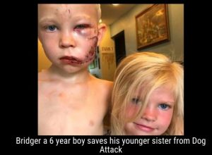 Bridger a 6 year boy saves his younger sister from Dog Attack